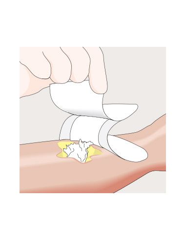 Mesalt medicazione in cloruro di sodio 5x5 1pz