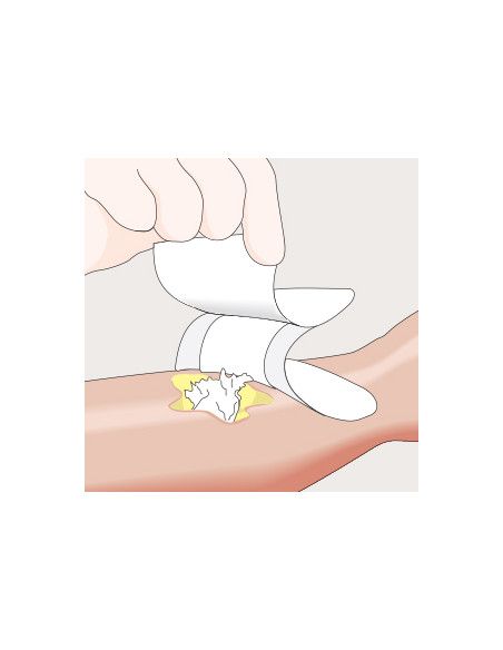 Mesalt medicazione in cloruro di sodio 5x5 1pz