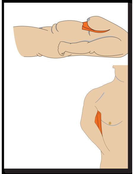 Ligasano Orange Prevenzione poliuretano espanso elastico 55x45x2 7pz