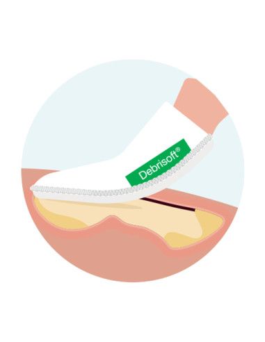 Debrisoft Pad sbrigliamento ferite superficiali croniche e acute 5pz