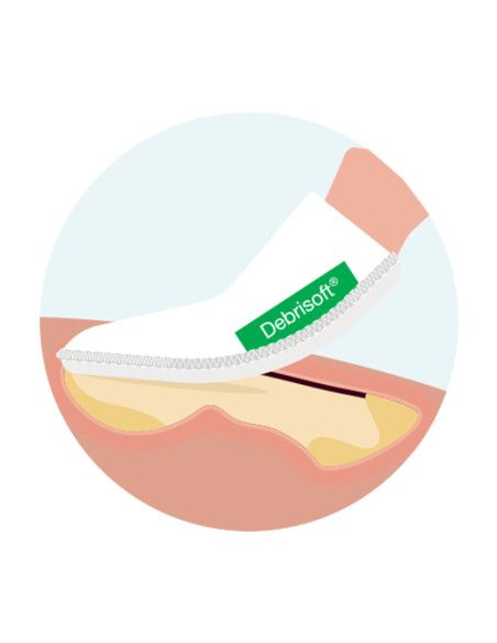 Debrisoft Pad sbrigliamento ferite superficiali croniche e acute 5pz Debrisoft Pad sbrigliamento ferite superficiali croniche e acute 5pz