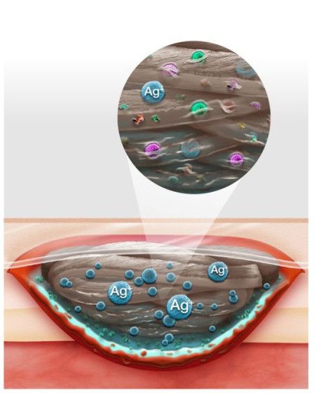 Suprasorb Liquacel Ag medicazione antimicrobica con argento 1pz