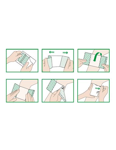 Suprasorb F Protect 5x7 | Medicazione Autoadesiva Trasparente | Per Ferite Acute e Croniche