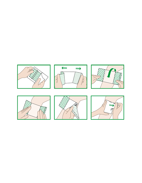 Suprasorb F Protect 5x7 | Medicazione Autoadesiva Trasparente | Per Ferite Acute e Croniche Suprasorb F Protect 5x7 | Medicazione Autoadesiva Trasparente | Per Ferite Acute e Croniche