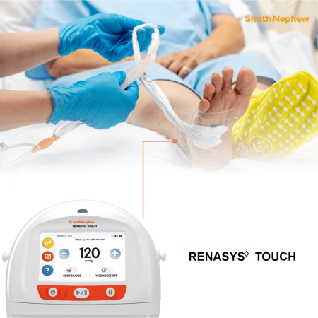 Renasys Touch | Terapia a Pressione Negativa | Trattamento per Ferite Complesse | NOLEGGIO
