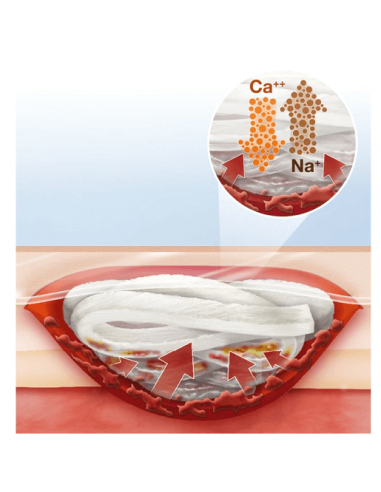 Suprasorb A Pro medicazione assorbente in alginato di calcio