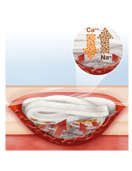 Suprasorb A Pro medicazione assorbente in alginato di calcio