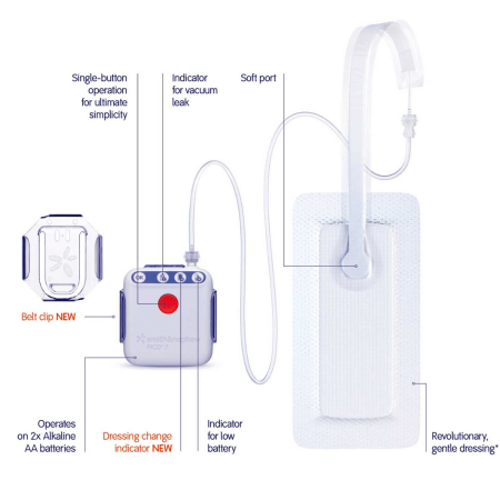 Pico 7 sistema monouso per la terapia a pressione negativa
