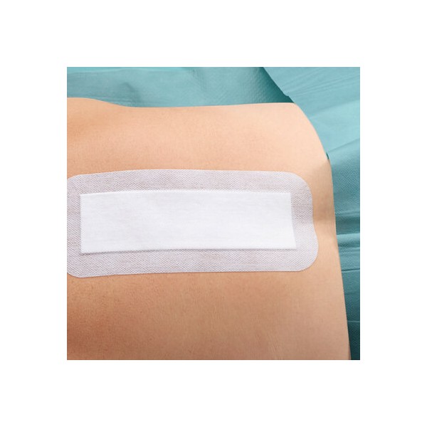 Cosmopor E | Medicazione Adesiva Sterile per Ferite Chirurgiche |20 x10 cm|25 Pezzi
