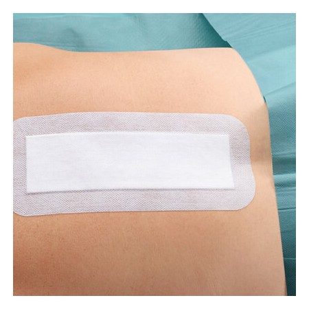 Cosmopor E | Medicazione Adesiva Sterile per Ferite Chirurgiche |20 x10 cm|25 Pezzi