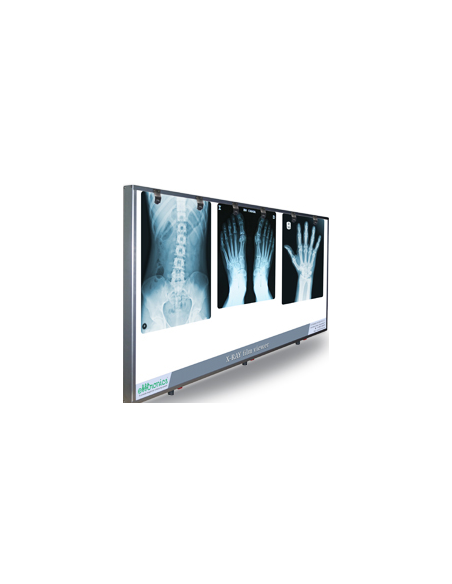 Negativoscopio in lamiera di acciaio verniciata bianca