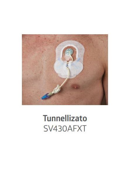 Sorbaview® Shield Medicazione e sistema di fissaggio integrato Contour 9,5X11,8 cm con finestra