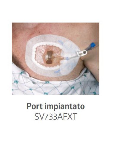 Sorbaview® Shield Medicazione e sistema di fissaggio integrato Oval 12,1X15,9 cm con finestra