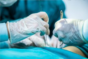 gestione della stomia dopo l'intervento