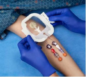 medicazioni di fissaggio per cateteri e cannule