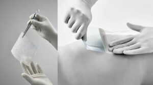 frequenza cambio medicazione avanzata