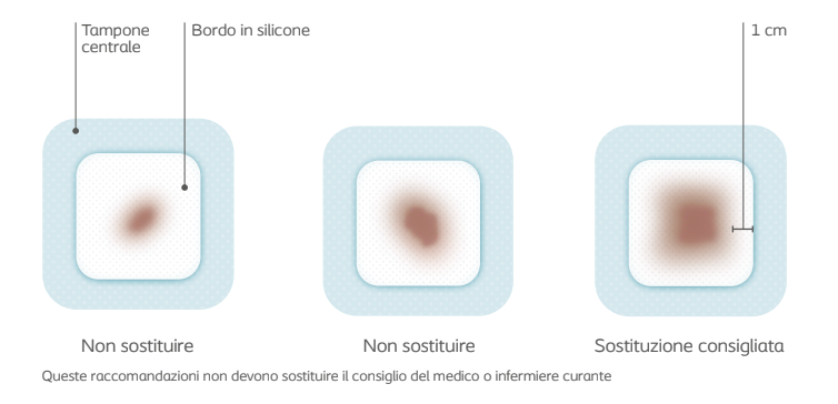 Ogni quanto cambiare una medicazione avanzata? Fattori da considerare frequenza cambio medicazione avanzata