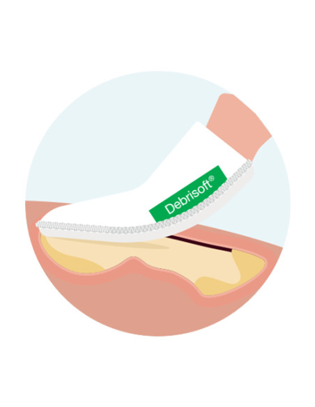 Debrisoft Pad sbrigliamento ferite superficiali croniche e acute 5pz